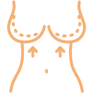Mamoplastia