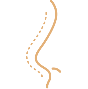 Rinoplastia